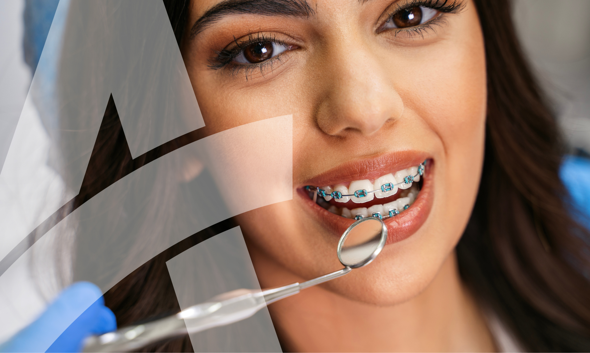 Why Orthodontic Coverage In Dental Insurance Is A Priority   Orthodontic Coverage 