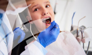 Early orthodontic treatment for kids.