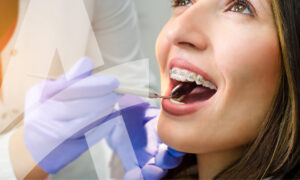 Expand your dental practice with orthodontic courses.